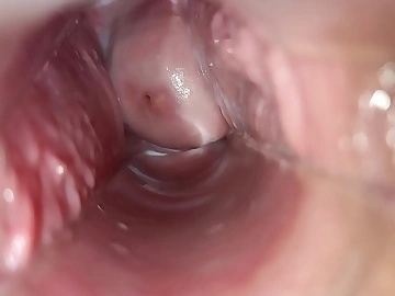 cực khoái âm đạo